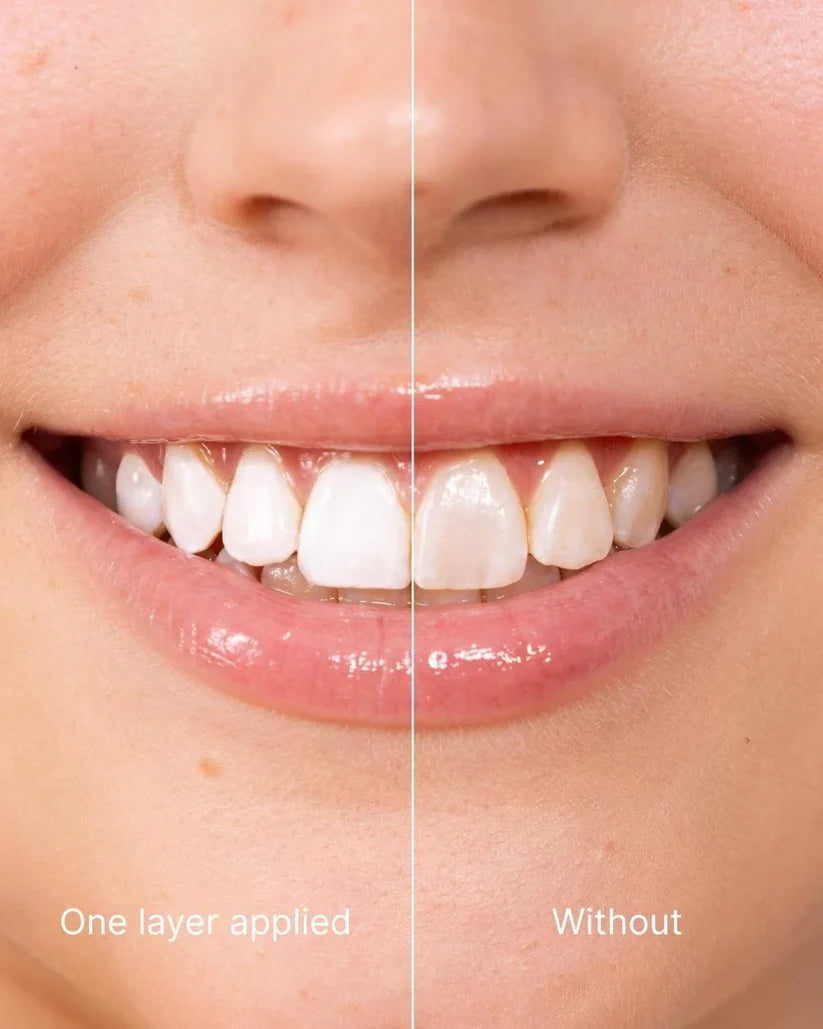 🔥2026 New Year Special Offer—Aegiri Tooth Polish - Instant Clean Smile