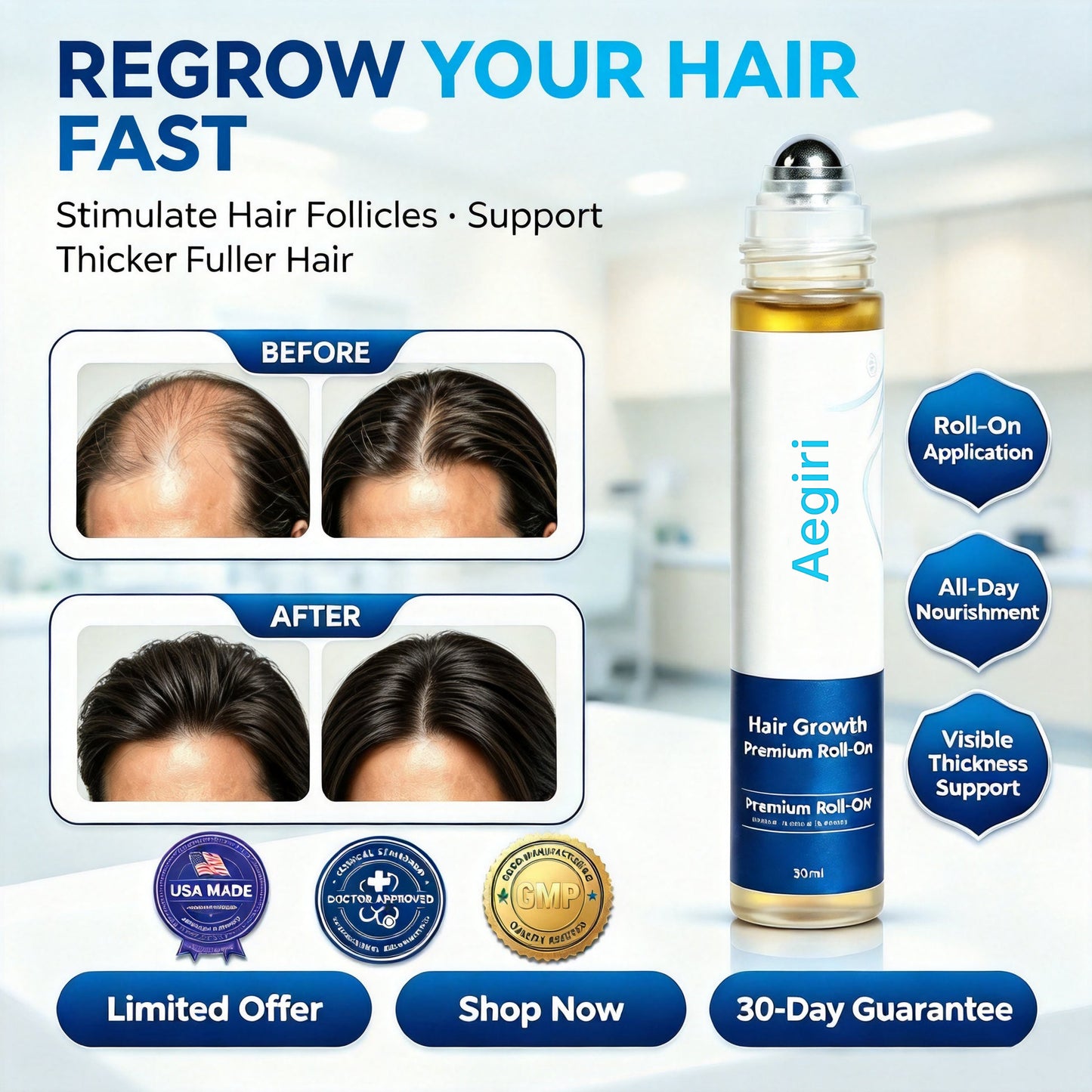 Aegiri Hair Growth Rollon Serum