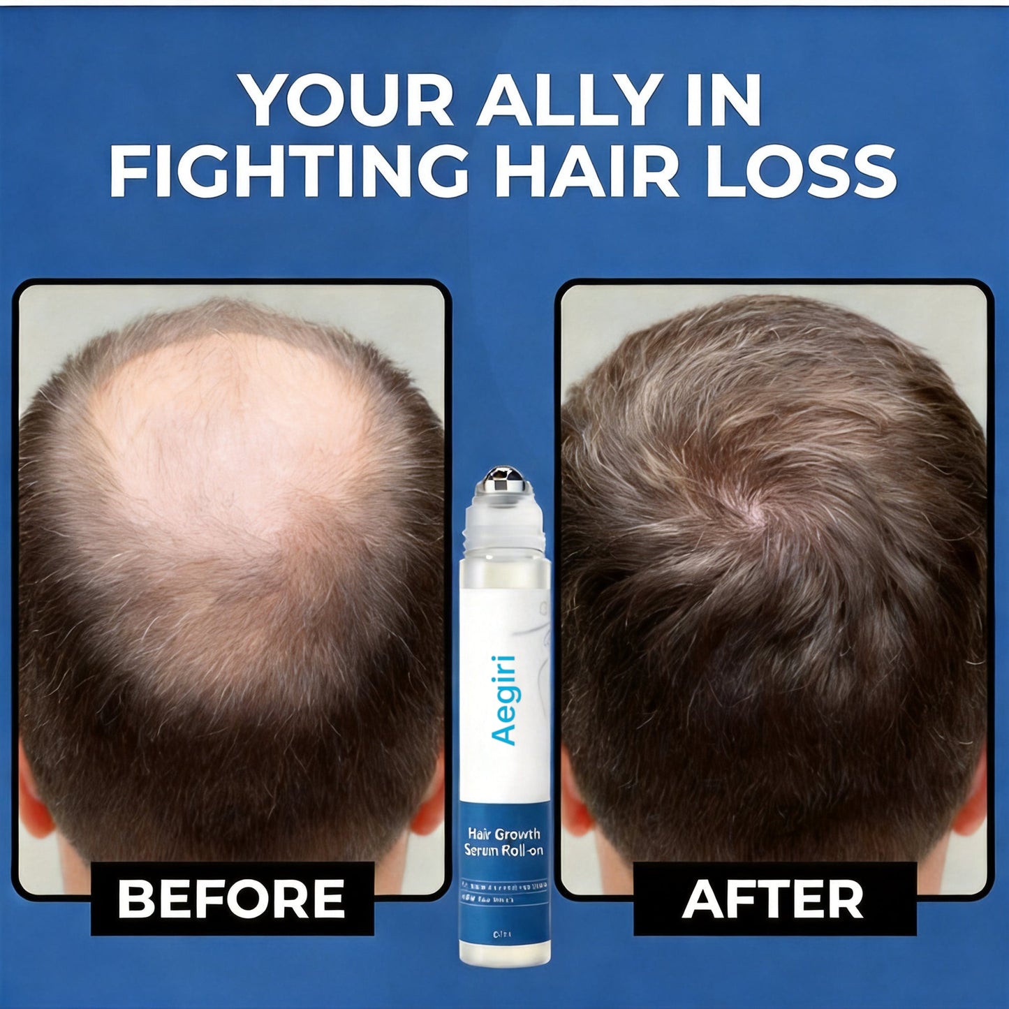 Aegiri Hair Growth Rollon Serum