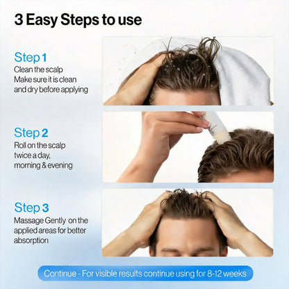 Aegiri Hair Growth Rollon Serum