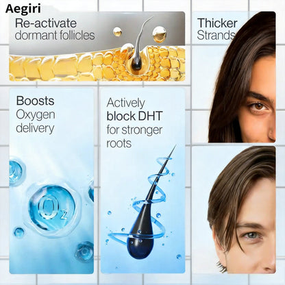 Aegiri Hair Growth Rollon Serum