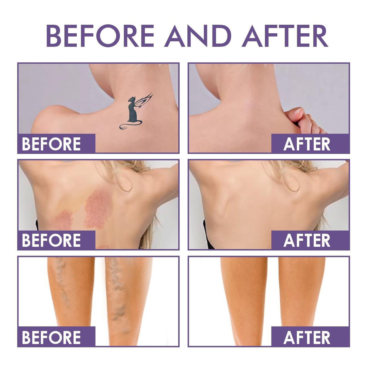 ✨Body Coverage Perfector – Waterproof, Lightweight & Flawless Body Makeup