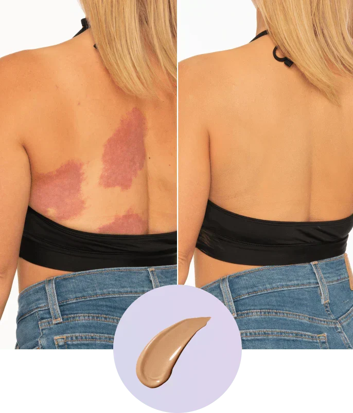 ✨Body Coverage Perfector – Waterproof, Lightweight & Flawless Body Makeup