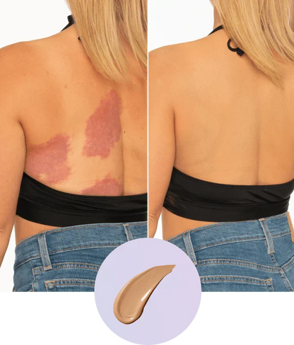 ✨Body Coverage Perfector – Waterproof, Lightweight & Flawless Body Makeup