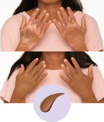 ✨Body Coverage Perfector – Waterproof, Lightweight & Flawless Body Makeup