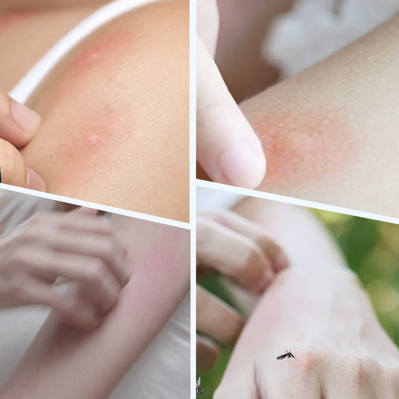 🛡️ 2026 Upgraded Ultrasonic Mosquito Repellent Bracelet - Powerful & Non-Toxic